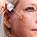 Retinoids: The Professional and Effective Solution for Acne in NYC