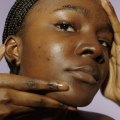 Pollution and Acne: A Comprehensive Guide to Managing and Preventing Acne in NYC