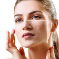 Diet and Acne: Understanding Causes, Prevention, and Treatment in NYC