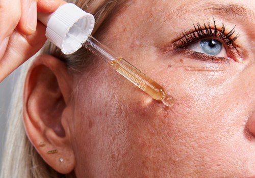 Retinoids: The Professional and Effective Solution for Acne in NYC